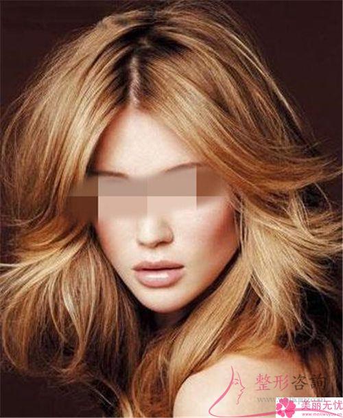 87天假体硅胶下巴能完全自然吗？5133能实行吗？
