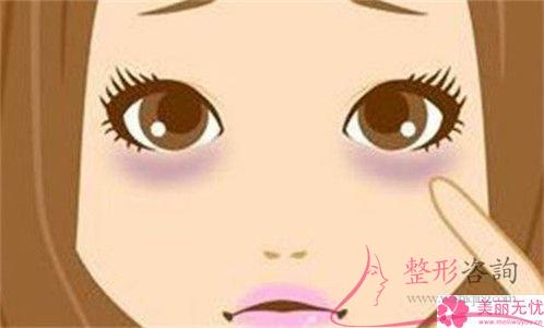 实行一回botox<a href=http://www.mx185.com/listinfo-679-0.html target=_blank class=infotextkey>瘦小腿</a>有哪些整形效果