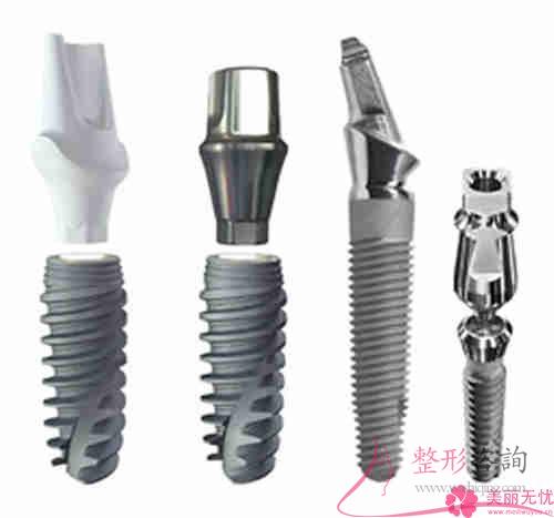 种植牙的种植体常规的种植牙材料都有几个？价钱要多少