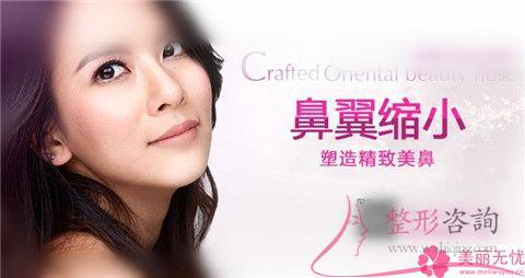 不美观的鼻翼应该怎么办