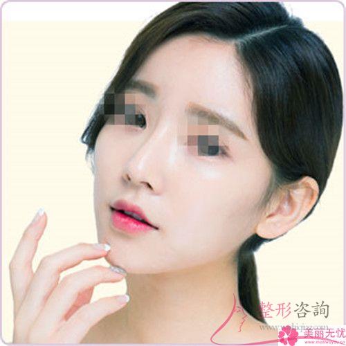 做<a href=http://www.mx185.com/listinfo-744-0.html target=_blank class=infotextkey>鼻骨矫正</a>多长时间能做好？术后效果怎样？