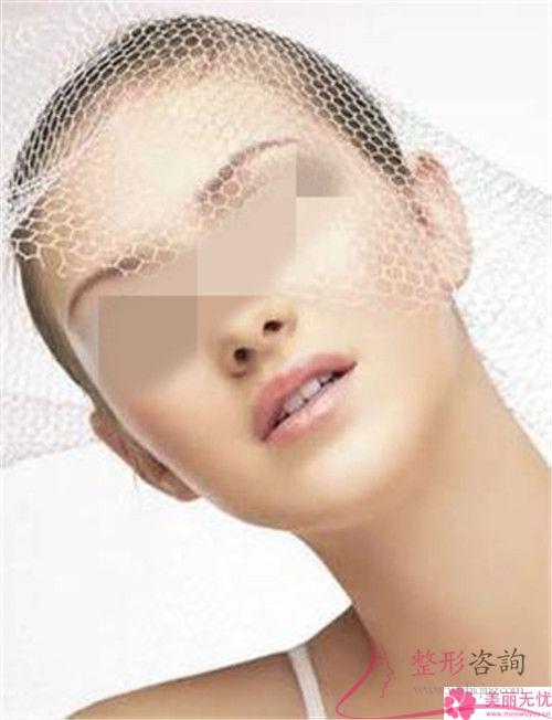 去整形美容机构做激光去痣贵不？多少元钱一颗