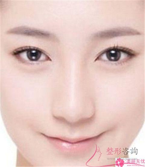<a href=http://www.mx185.com/listinfo-754-0.html target=_blank class=infotextkey>鼻翼</a>美容整形术方式都有哪几种