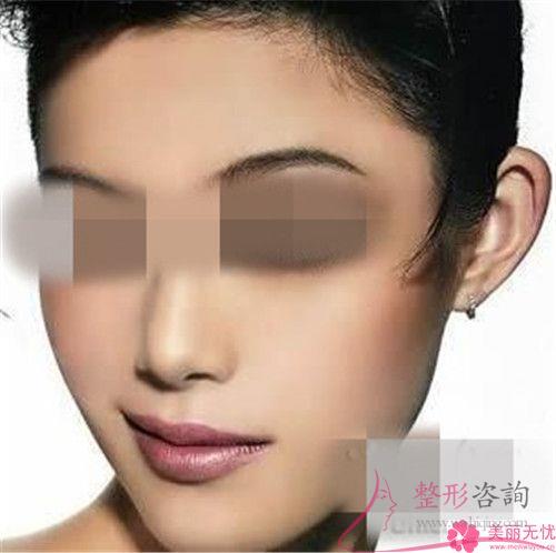 伤口沾水后不利于自体脂肪<a href=http://www.mx185.com/listinfo-694-0.html target=_blank class=infotextkey>丰耳垂</a>后的恢复吗