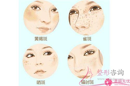 <a href=http://www.mx185.com/listinfo-768-0.html target=_blank class=infotextkey>微针</a>去斑安全性高吗