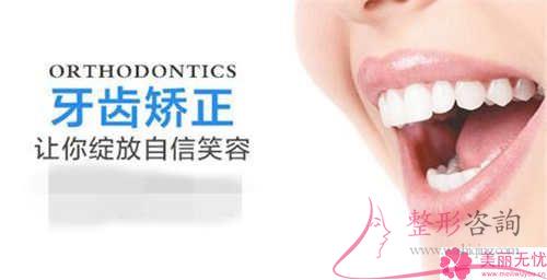 最科学的牙齿矫正类型具体有哪些