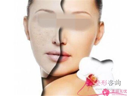 <a href=http://www.mx185.com/listinfo-795-0.html target=_blank class=infotextkey>祛斑</a>大约费用