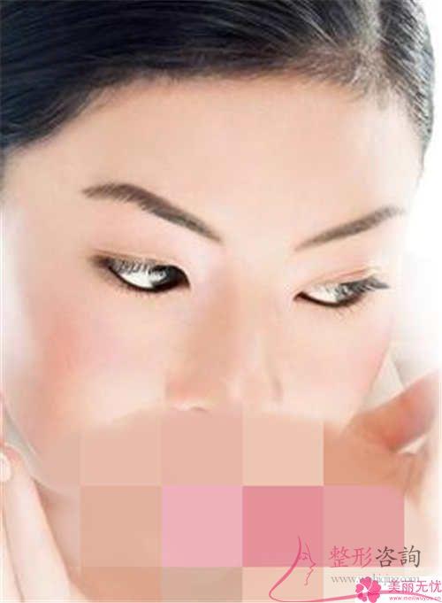 超声法<a href=http://www.mx185.com/listinfo-708-0.html target=_blank class=infotextkey>去眼袋</a>多久可以恢复好