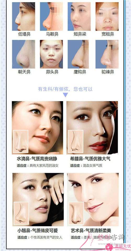 假体<a href=http://www.mx185.com/listinfo-737-0.html target=_blank class=infotextkey>隆鼻</a>效果若何显现呢