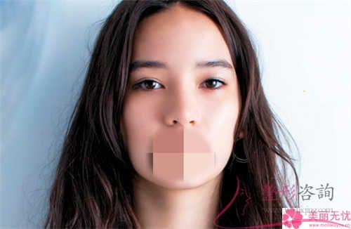 手术<a href=http://www.mx185.com/listinfo-614-0.html target=_blank class=infotextkey>除皱</a>好久可以变得自然