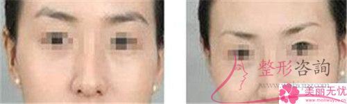 <a href=http://www.mx185.com/listinfo-658-0.html target=_blank class=infotextkey>洗眉</a>毛用激光能清洁净吗？费用是呢