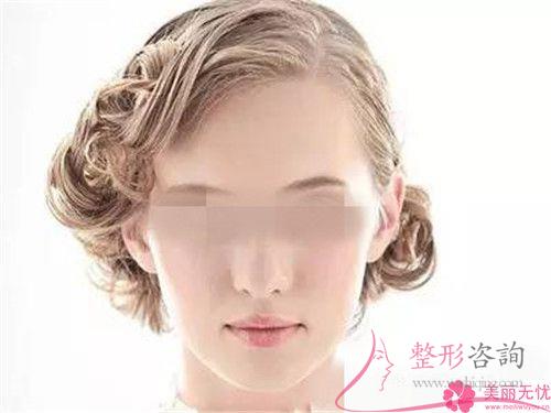 激光<a href=http://www.mx185.com/listinfo-774-0.html target=_blank class=infotextkey>去雀斑</a>样痣最终价格贵吗？多少元钱