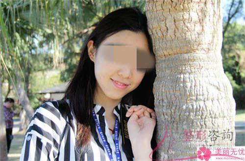 <a href=http://www.mx185.com/listinfo-629-0.html target=_blank class=infotextkey>下颌角</a>整形手术哪一个项目美容效果好