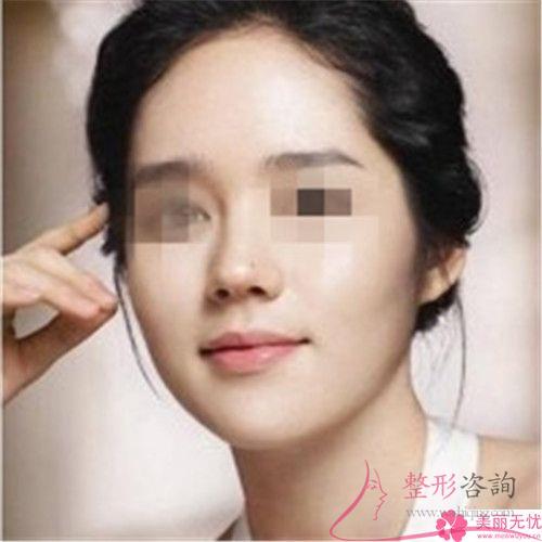 <a href=http://www.mx185.com/listinfo-737-0.html target=_blank class=infotextkey>隆鼻</a>手术失败具体是由于什么原因造成