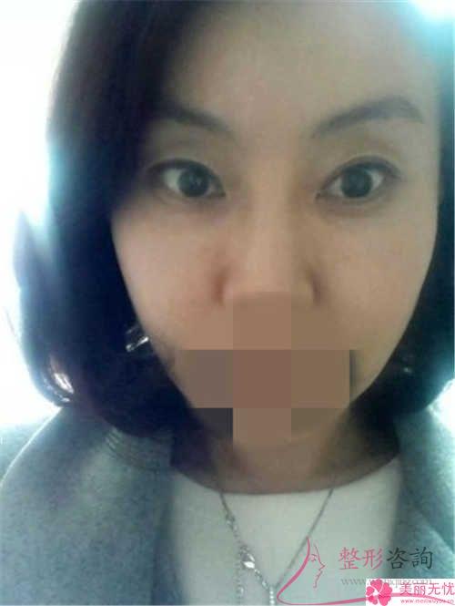 利用干细胞<a href=http://www.mx185.com/listinfo-614-0.html target=_blank class=infotextkey>除皱</a>抗衰能起作用吗