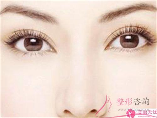 半切<a href=http://www.mx185.com/listinfo-724-0.html target=_blank class=infotextkey>双眼皮</a>手术合适哪些人群