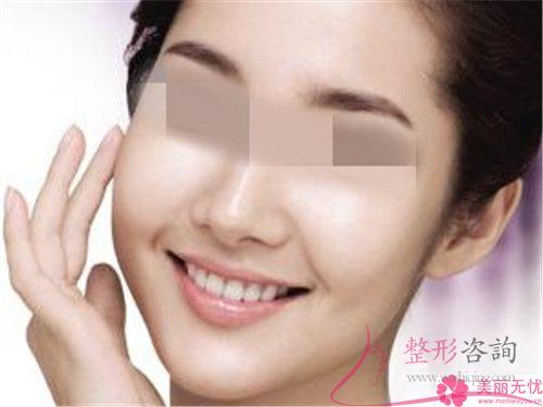 提拉面部哪个收入阶层的美丽女性得以实行