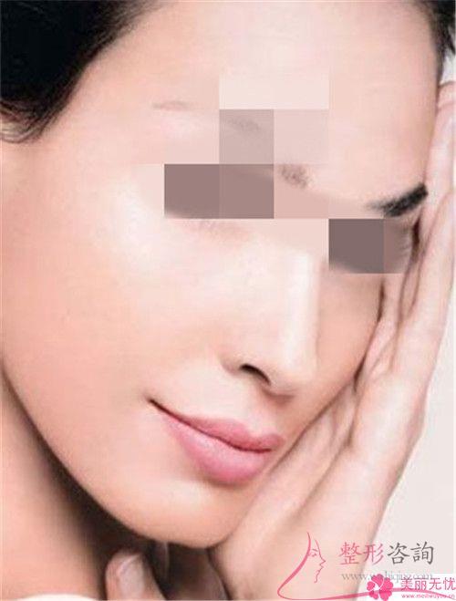 提拉面部哪个收入阶层的美丽女性得以实行