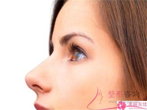 毛孔粗能实行彩光<a href=http://www.mx185.com/listinfo-770-0.html target=_blank class=infotextkey>嫩肤</a>吗