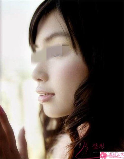 <a href=http://www.mx185.com/listinfo-629-0.html target=_blank class=infotextkey>下颌角</a>截骨手术的费用在12154-21849元之间吗