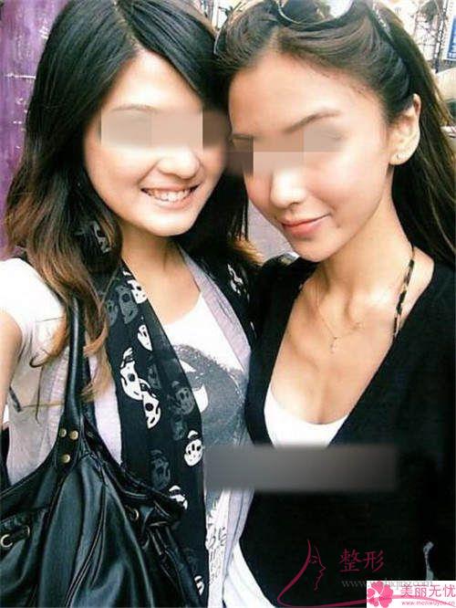<a href=http://www.mx185.com/listinfo-629-0.html target=_blank class=infotextkey>下颌角</a>截骨手术的费用在12154-21849元之间吗
