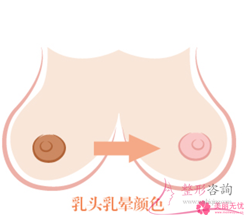 进行<a href=http://www.mx185.com/listinfo-625-0.html target=_blank class=infotextkey>乳晕缩小</a>术之前需要避免服用什么药物