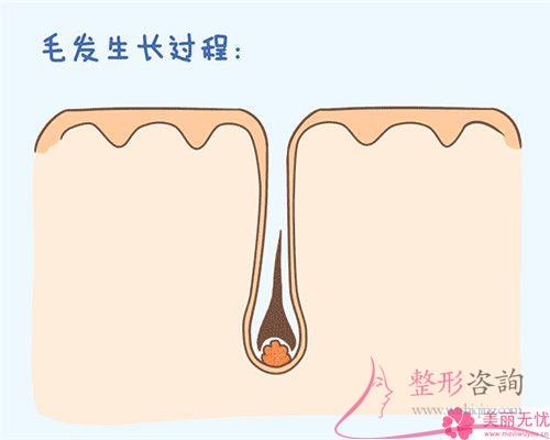 做一次E光永久<a href=http://www.mx185.com/listinfo-670-0.html target=_blank class=infotextkey>脱毛</a>要花多少钱