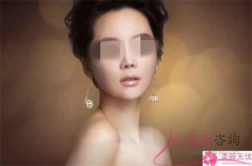 <a href=http://www.mx185.com/listinfo-737-0.html target=_blank class=infotextkey>隆鼻</a>术整形效果有哪些