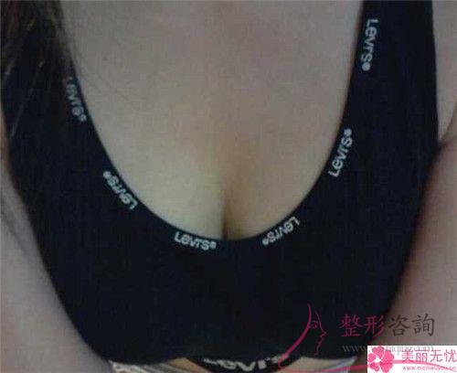 女性实施<a href=http://www.mx185.com/listinfo-625-0.html target=_blank class=infotextkey>乳晕缩小</a>手术的成功率是100%吗