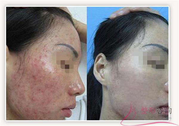 1931487877 1931487877