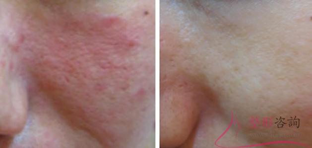 1217178276 1217178276