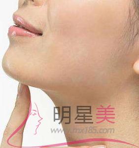 <a href=http://www.mx185.com/listinfo-635-0.html target=_blank class=infotextkey>去颊脂垫</a>为什么没效果