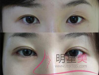 涂什么可以长眉毛