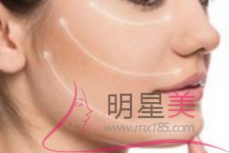 整容全脸价格