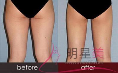 怎么坐着瘦肌肉腿