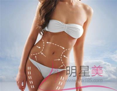 抽脂后恢复期多久