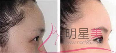 怀孕能刮眉毛吗