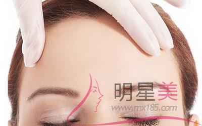 人造酒窝有哪些