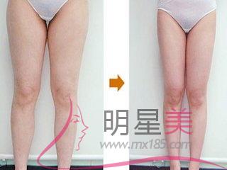 最有效<a href=http://www.mx185.com/listinfo-684-0.html target=_blank class=infotextkey>瘦大腿</a>内侧