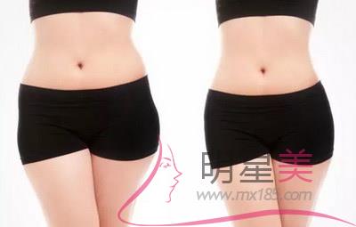 打<a href=http://www.mx185.com/listinfo-631-0.html target=_blank class=infotextkey>瘦脸</a>针脸会肿多久