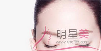 宝宝出生后脸上有胎记是什么导致的