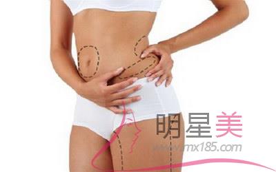 抽脂肚子减肥价格