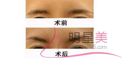 来例假第四天可以纹眉毛吗