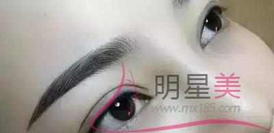 纹眉组织液是什么