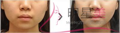 每天拍脸能<a href=http://www.mx185.com/listinfo-631-0.html target=_blank class=infotextkey>瘦脸</a>吗