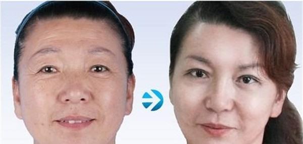 做<a href=http://www.mx185.com/listinfo-731-0.html target=_blank class=infotextkey>玻尿酸</a><a href=http://www.mx185.com/listinfo-765-0.html target=_blank class=infotextkey>去抬头纹</a>价格