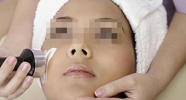 激光去除黄褐斑多少钱