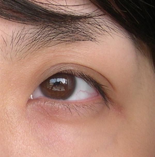 <a href=http://www.mx185.com/listinfo-782-0.html target=_blank class=infotextkey>去眼角细纹</a>失败修复价格