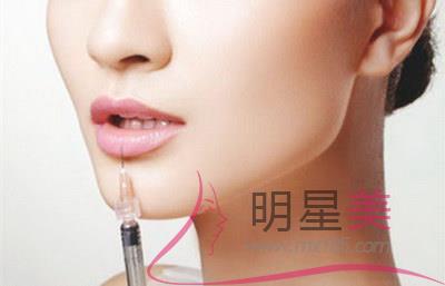 四十岁女人脸有皱纹