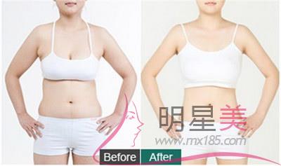 怎么样瘦腰提臀